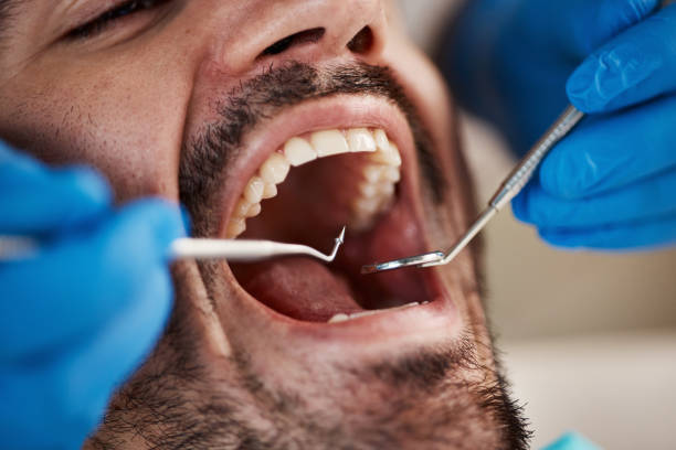 Best Emergency Dental Care for Broken or Chipped Teeth in Minersville, PA